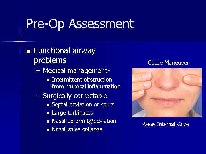 Pre-Op Assessment n Functional airway problems – Medical managementn Cottle Maneuver Intermittent obstruction from