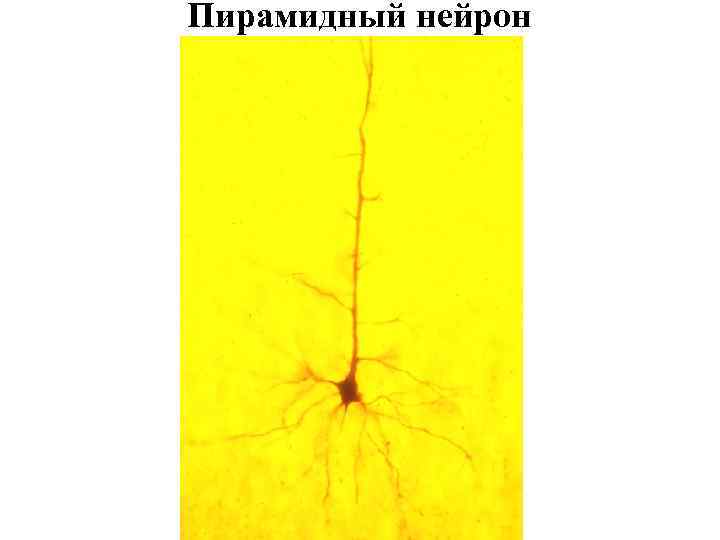 Пирамидный нейрон 