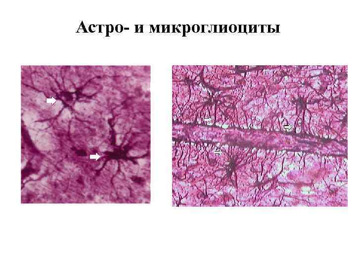 Астро- и микроглиоциты 