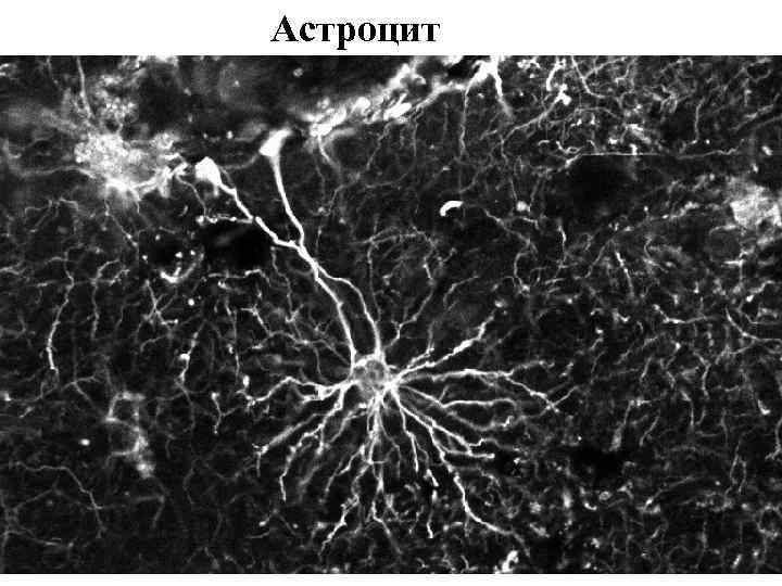 Астроцит 