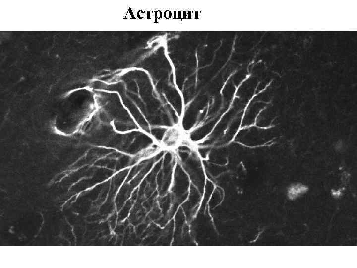Астроцит 