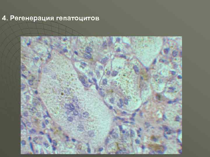 4. Регенерация гепатоцитов 