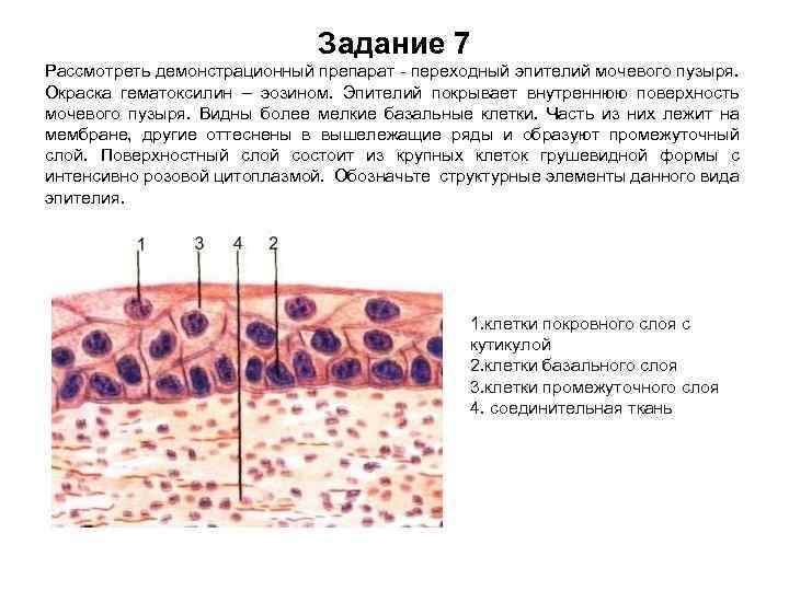 Задание 7 Рассмотреть демонстрационный препарат - переходный эпителий мочевого пузыря. Окраска гематоксилин – эозином.