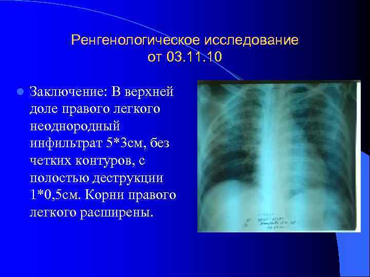 Рентгеновское изображение получают в результате неоднородного