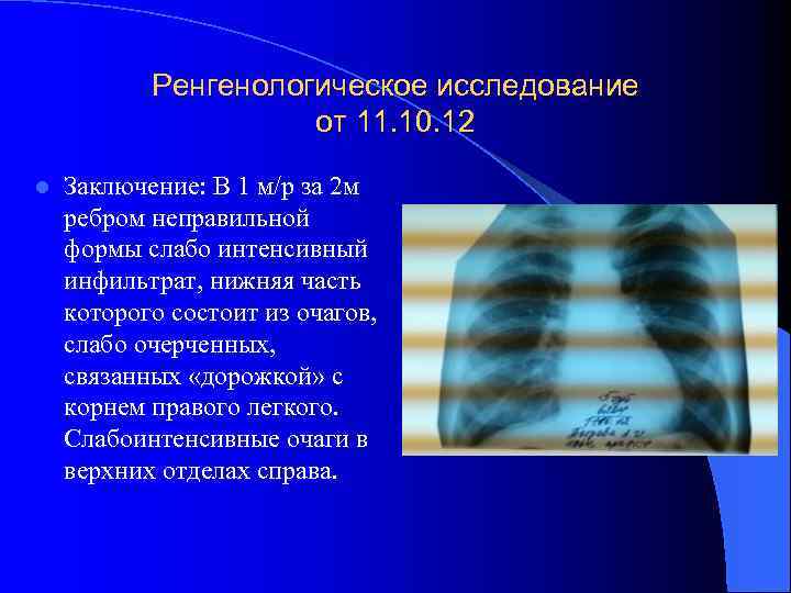 Ренгенологическое исследование от 11. 10. 12 l Заключение: В 1 м/р за 2 м