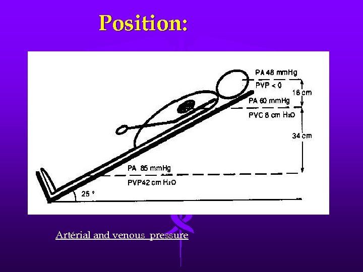 Position: Artérial and venous pressure 