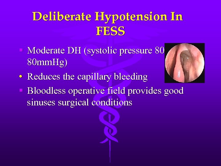 Deliberate Hypotension In FESS § Moderate DH (systolic pressure 80 80 mm. Hg) •