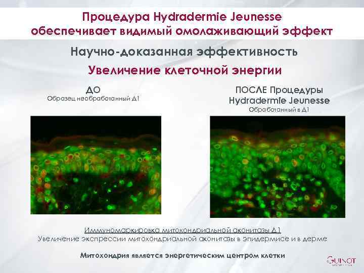Процедура Hydradermie Jeunesse обеспечивает видимый омолаживающий эффект Научно-доказанная эффективность Увеличение клеточной энергии ДО ПОСЛЕ