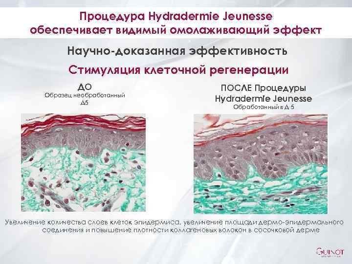 Процедура Hydradermie Jeunesse обеспечивает видимый омолаживающий эффект Научно-доказанная эффективность Стимуляция клеточной регенерации ДО Образец