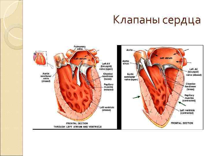 Клапаны сердца на рентгене