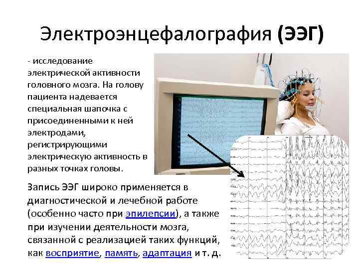  Электроэнцефалография (ЭЭГ) исследование электрической активности головного мозга. На голову пациента надевается специальная шапочка