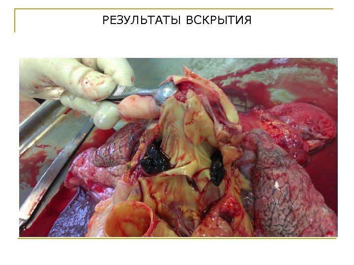 РЕЗУЛЬТАТЫ ВСКРЫТИЯ 