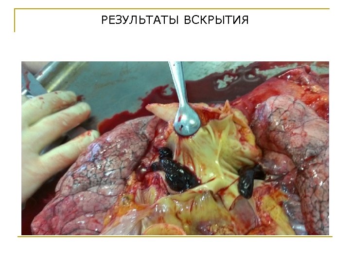 РЕЗУЛЬТАТЫ ВСКРЫТИЯ 
