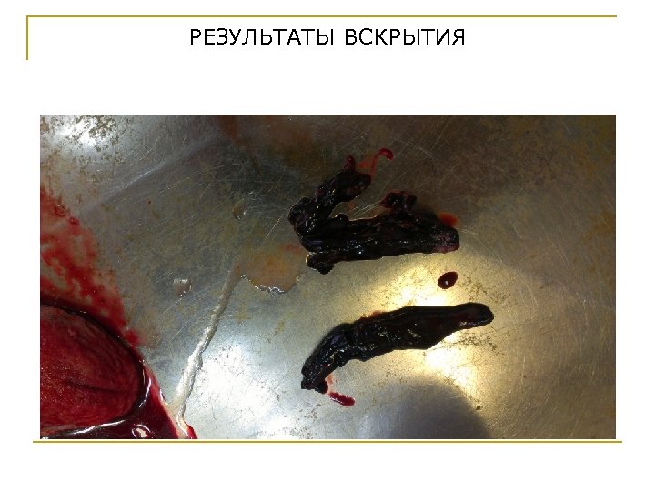 РЕЗУЛЬТАТЫ ВСКРЫТИЯ 