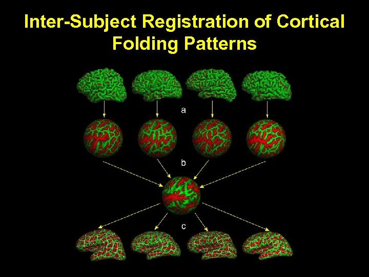 Inter-Subject Registration of Cortical Folding Patterns 