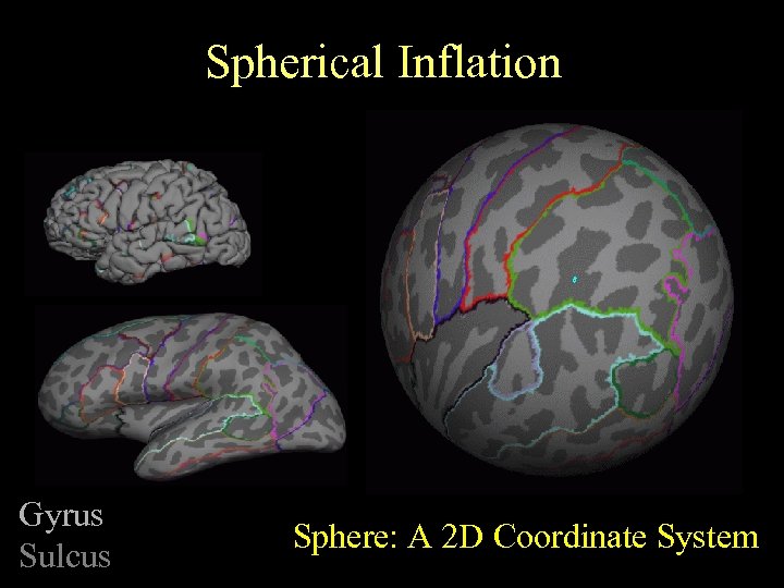 Spherical Inflation Gyrus Sulcus Sphere: A 2 D Coordinate System 