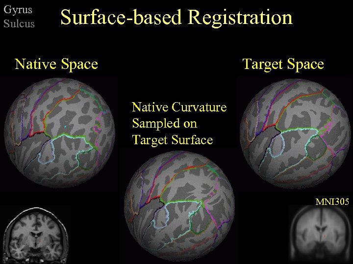 Gyrus Sulcus Surface-based Registration Native Space Target Space Native Curvature Sampled on Target Surface