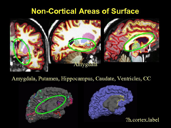 Non-Cortical Areas of Surface Amygdala, Putamen, Hippocampus, Caudate, Ventricles, CC ? h. cortex. label