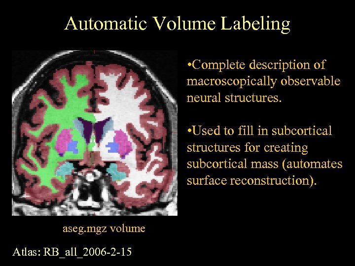 Automatic Volume Labeling • Complete description of macroscopically observable neural structures. • Used to