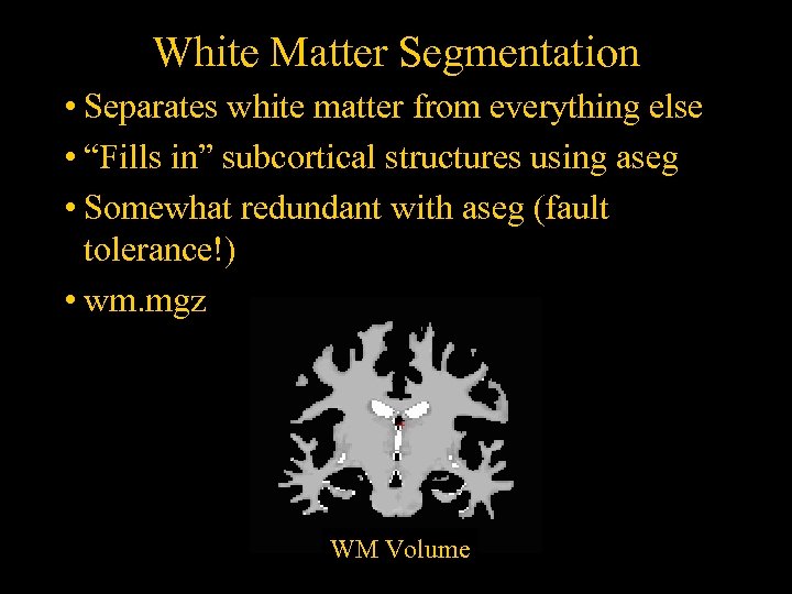 White Matter Segmentation • Separates white matter from everything else • “Fills in” subcortical