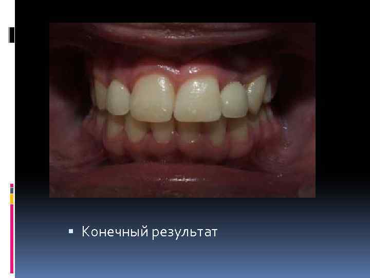  Конечный результат 