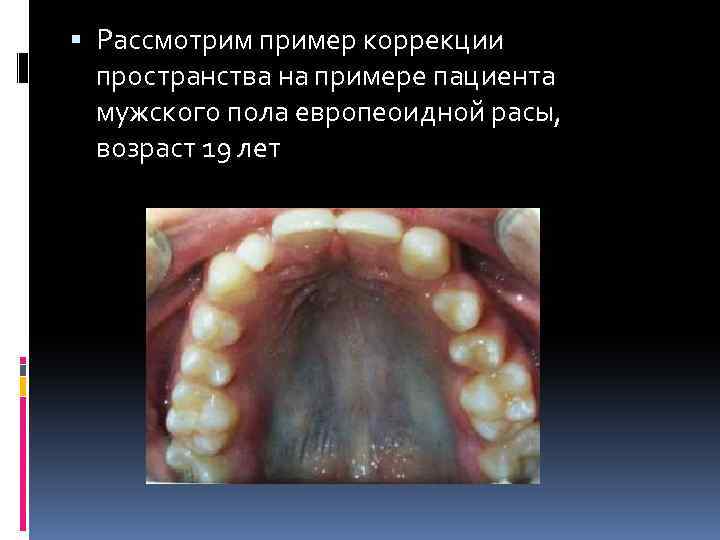  Рассмотрим пример коррекции пространства на примере пациента мужского пола европеоидной расы, возраст 19