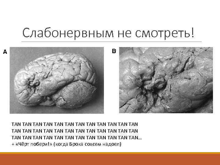 Слабонервным не смотреть! TAN TAN TAN TAN TAN TAN TAN TAN TAN… + «Чёрт