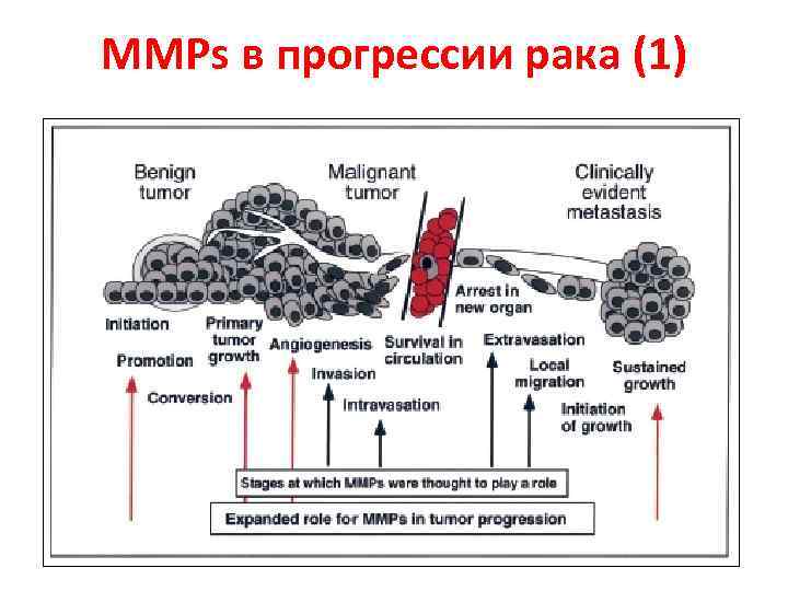 MMPs в прогрессии рака (1) 
