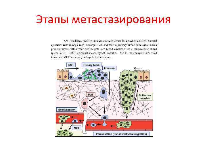 Этапы метастазирования 