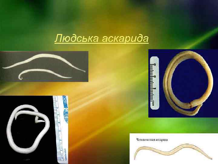 Людська аскарида 