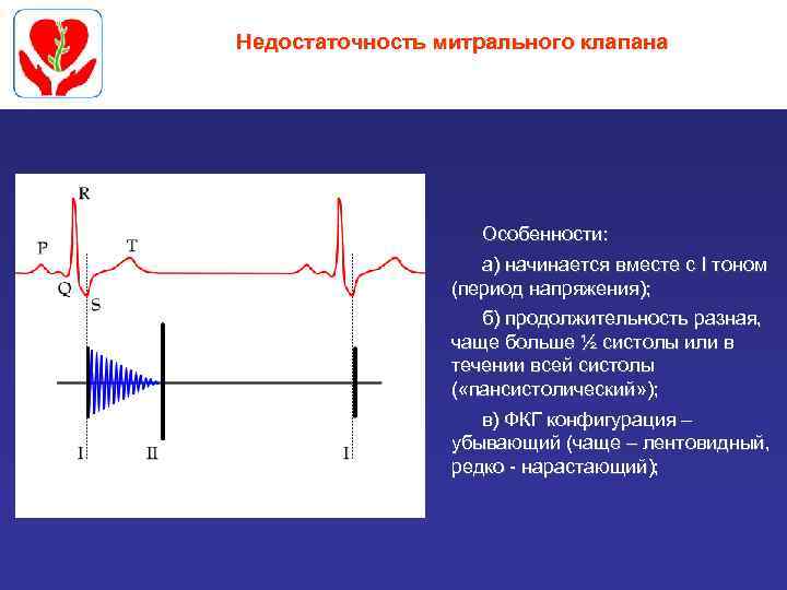 Недостаточность митрального клапана Особенности: а) начинается вместе с I тоном (период напряжения); б) продолжительность
