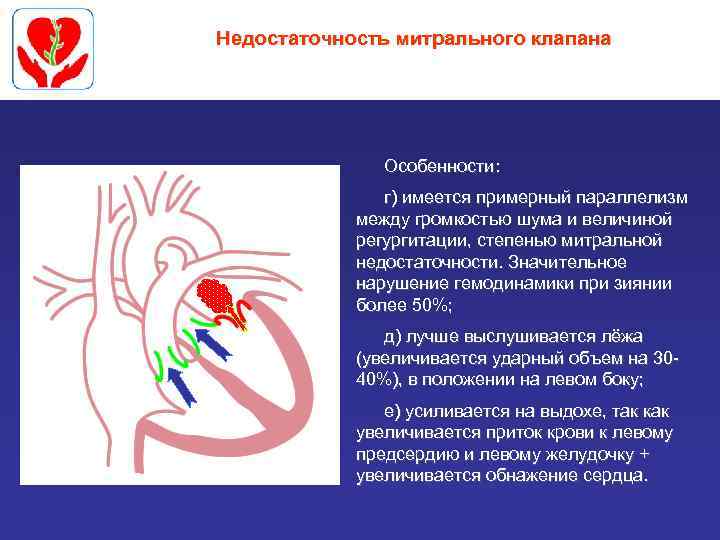 Недостаточность митрального клапана Особенности: г) имеется примерный параллелизм между громкостью шума и величиной регургитации,
