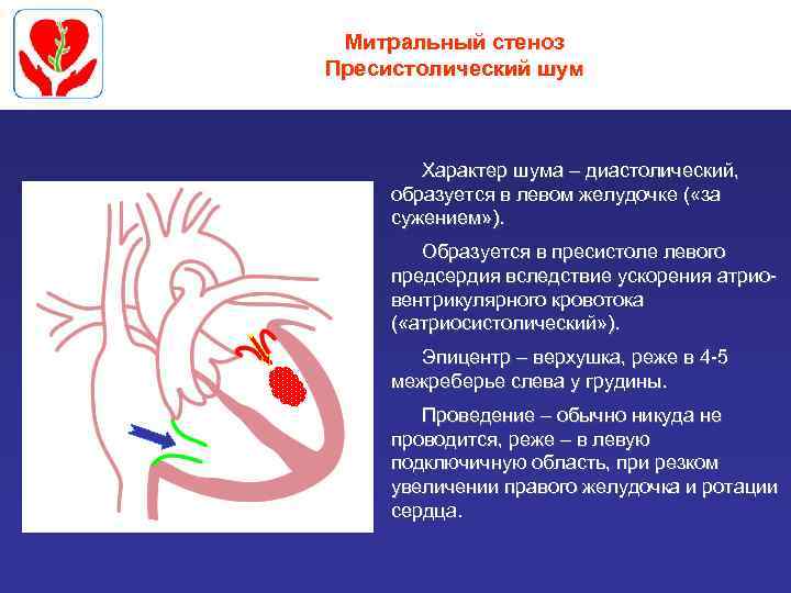Митральный стеноз Пресистолический шум Характер шума – диастолический, образуется в левом желудочке ( «за