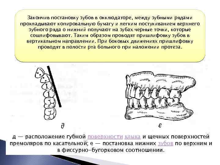 Постановка зубов по васильеву презентация