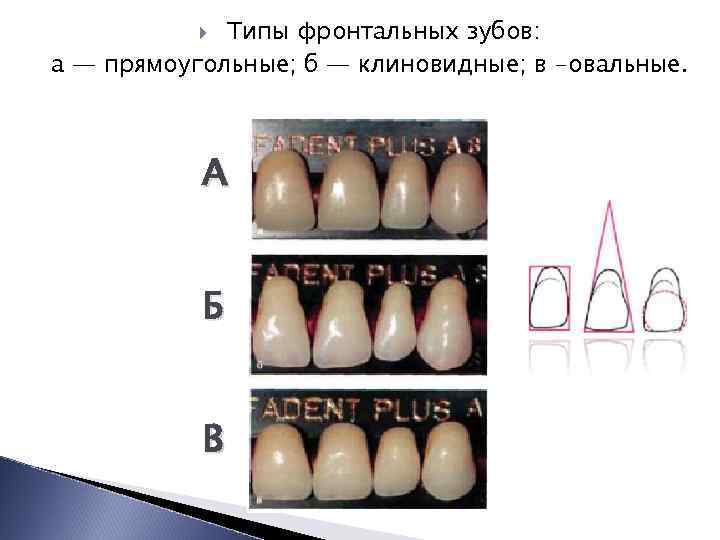 Искусственные зубы презентация