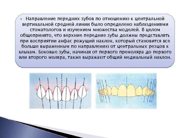 Каковы схемы зубофрезерования зубодолбления