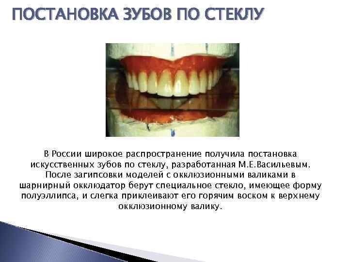 Искусственные зубы презентация