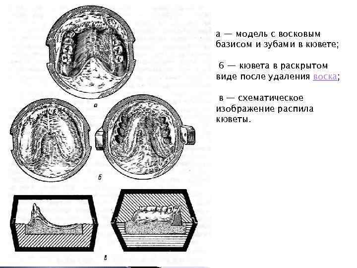 а — модель с восковым базисом и зубами в кювете; 6 — кювета в