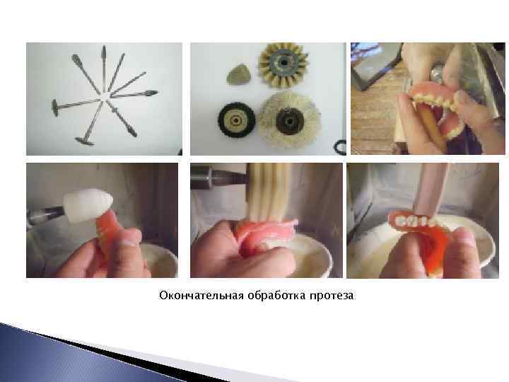 Окончательная обработка протеза 