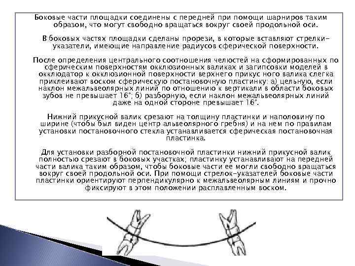 Боковые части площадки соединены с передней при помощи шарниров таким образом, что могут свободно