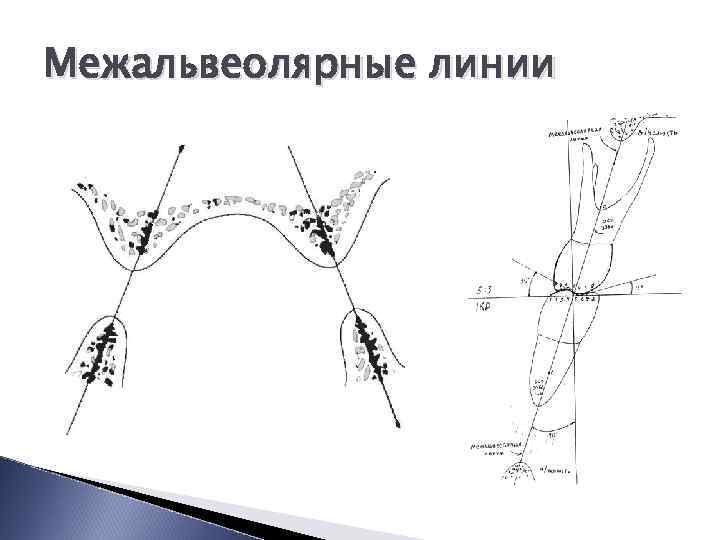 Постановка зубов по сферическим поверхностям презентация