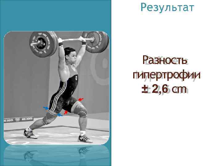 Результат Разность гипертрофии ± 2, 6 cm 
