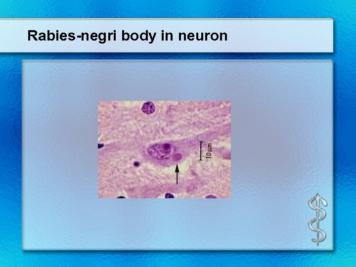 Rabies-negri body in neuron 