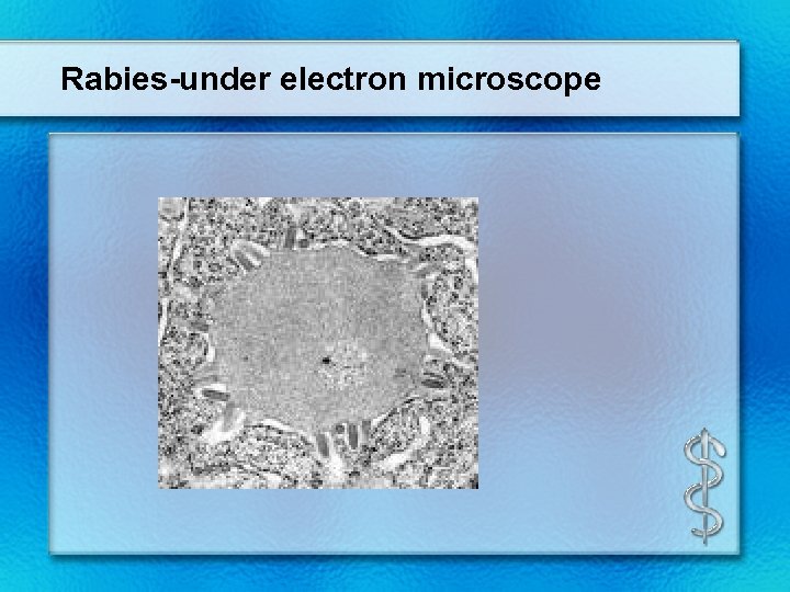 Rabies-under electron microscope 