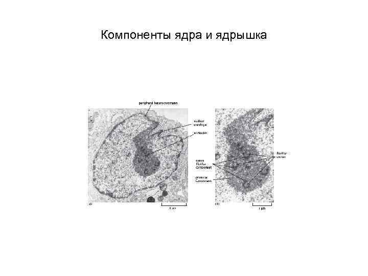 Главным структурным компонентом ядра является. Гранулярный компонент ядрышка. Микрофотография компоненты ядрышка. Гранулярный компонент ядрышка функции. Фибриллярный компонент ядрышка.