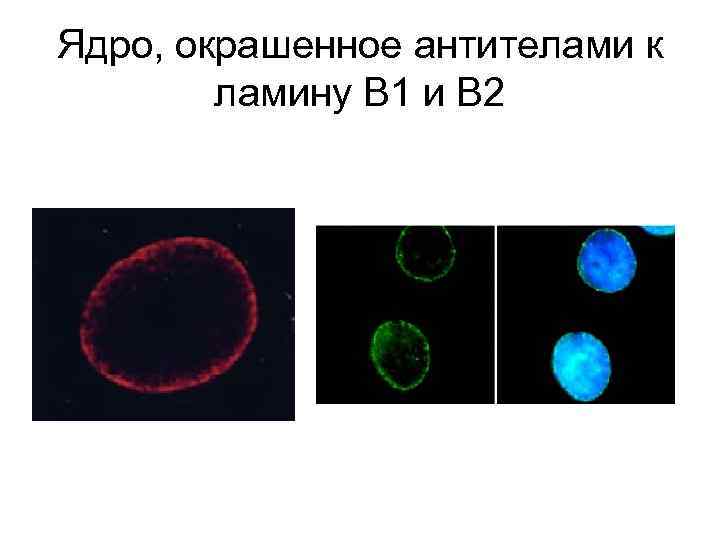 Ядро, окрашенное антителами к ламину В 1 и В 2 