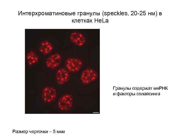 Интерхроматиновые гранулы (speckles, 20 -25 нм) в клетках He. La Гранулы содержат мя. РНК