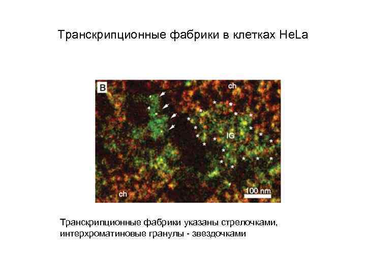 Транскрипционные фабрики в клетках He. La Транскрипционные фабрики указаны стрелочками, интерхроматиновые гранулы - звездочками