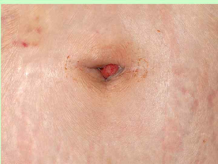 КАФЕДРА ХИРУРГИИ МОСКОВСКОГО ФАКУЛЬТЕТА 