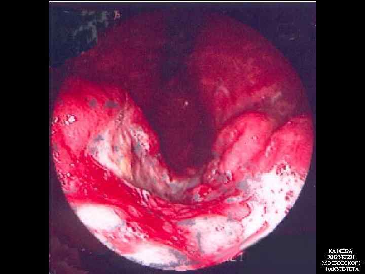 КАФЕДРА ХИРУРГИИ МОСКОВСКОГО ФАКУЛЬТЕТА 